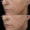 biotech-longevity-creme-Subject-11 IMAGE MD Biotech-voide