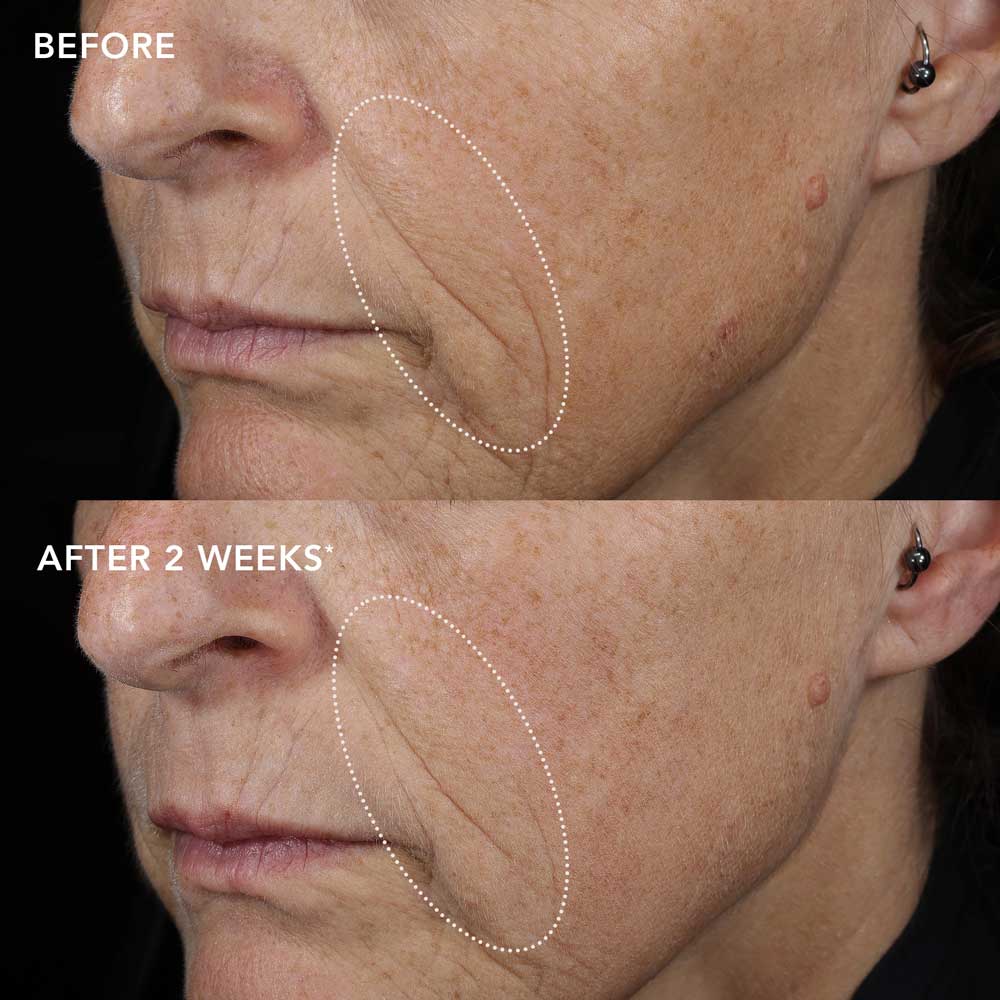 biotech-longevity-creme-Subject-11 IMAGE MD Biotech-voide