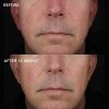 biotech-longevity-creme-Subject-4 IMAGE MD Biotech-voide
