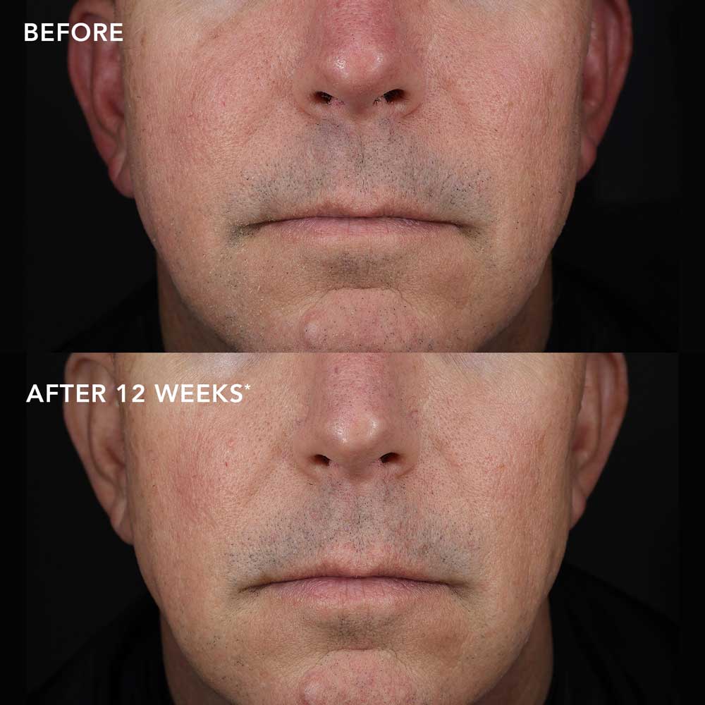 biotech-longevity-creme-Subject-4 IMAGE MD Biotech-voide