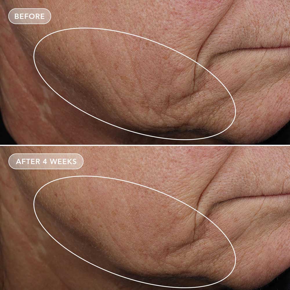 VOL.U.LIFT™ 4D SKIN REBOUND COMPLEX
